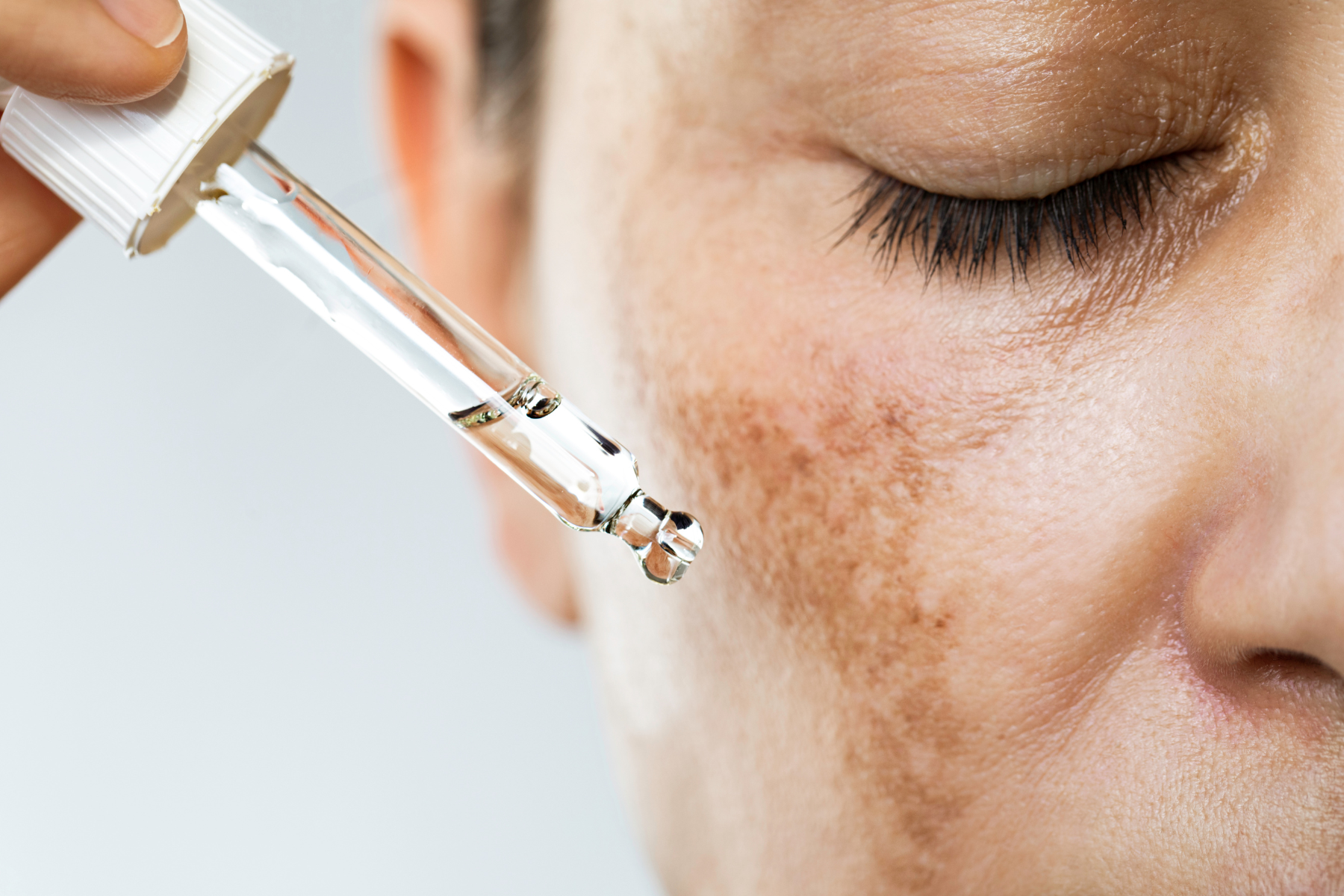 Woman applying serum to pigmented skin